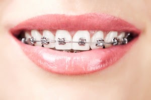 Summer Smile Dental South Gate place picture