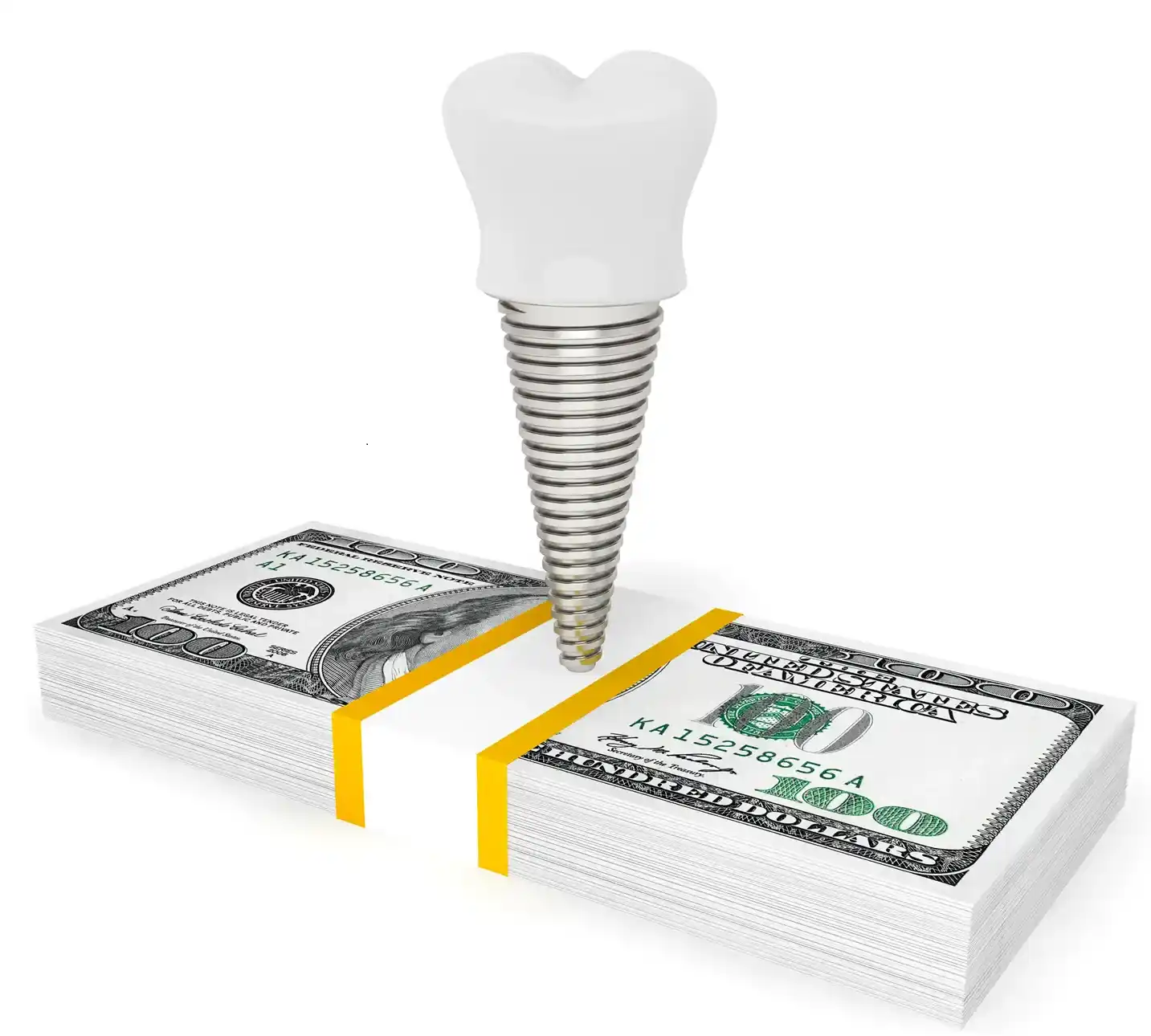 cost of the dental implants