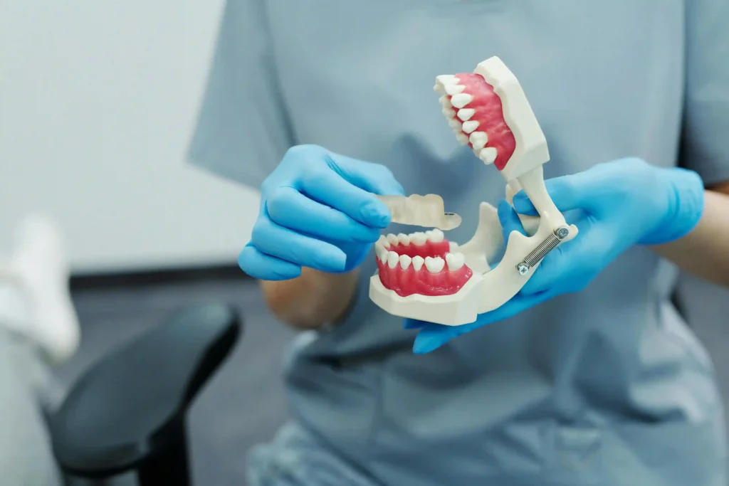 benefits of dental bridges