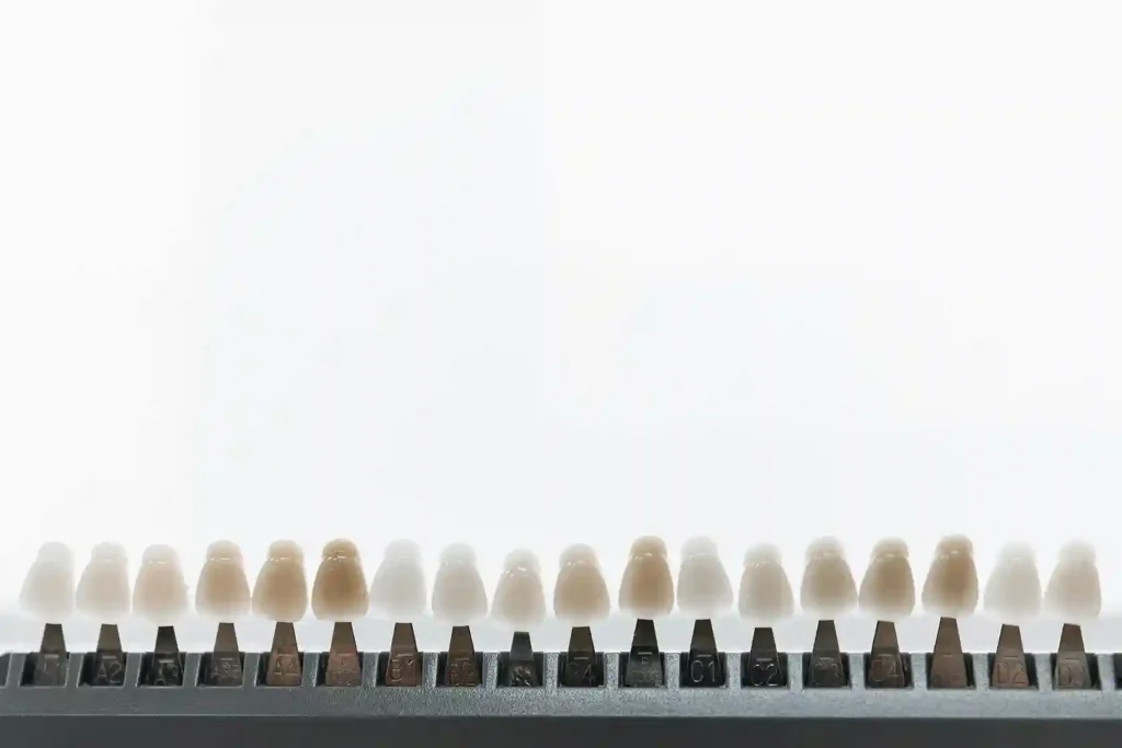 why choose us for dental veneers