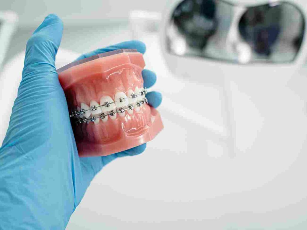 signs you may need orthodontic treatment
