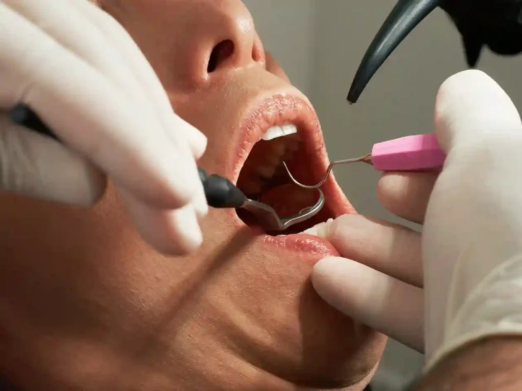 types of dental cleanings we offer