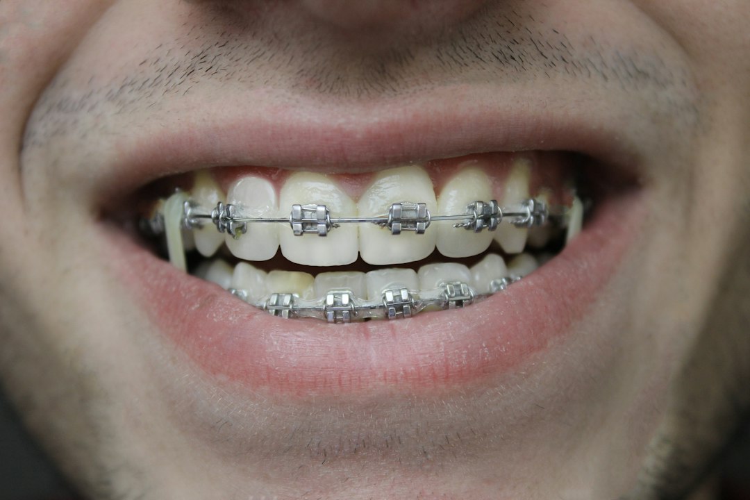 Close-up of a smile during orthodontic care