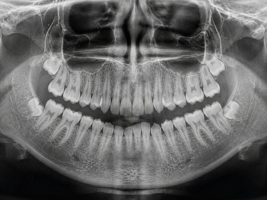 Panoramic dental X-ray of teeth and jaw