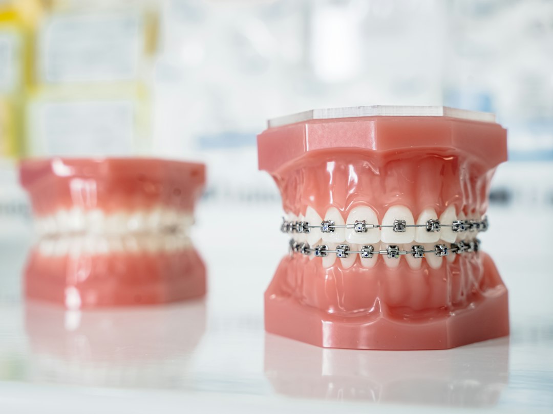 Close-up of teeth with dental braces