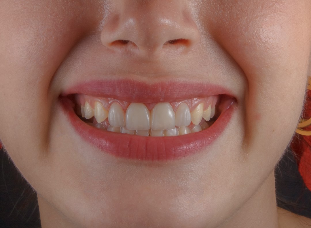 Close-up of a natural-looking smile with healthy teeth
